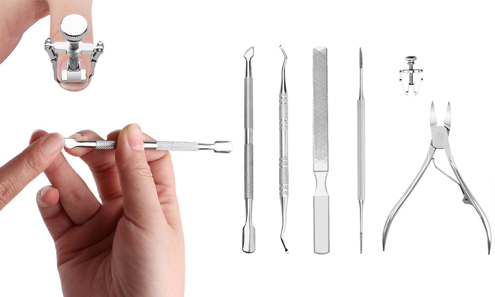 6 Piece Ingrown Nail Corrector Kit